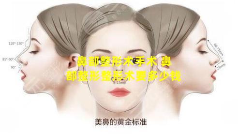 鼻部整形术手术 鼻部整形整形术要多少钱